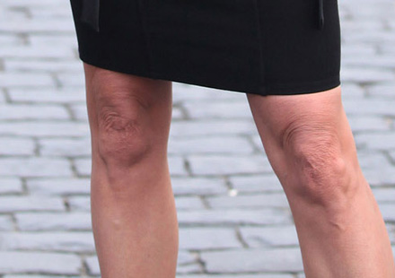 traitement-genoux-fripes